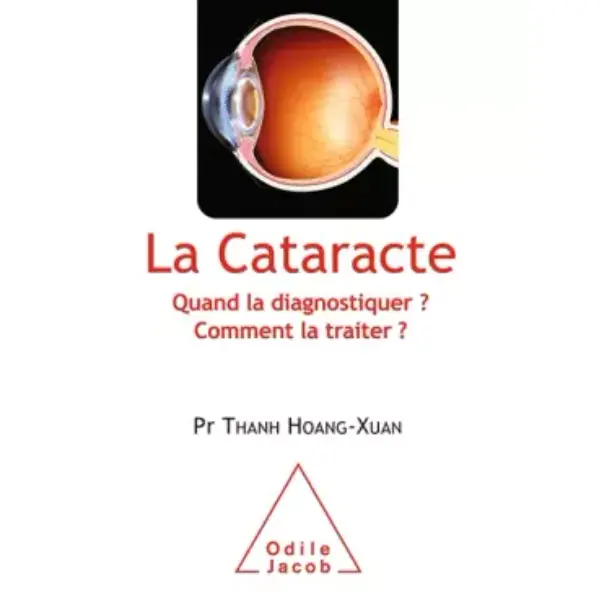 La Cataracte: Quand la diagnostiquer ? Comment la traiter ?